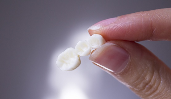 Person holding a dental bridge