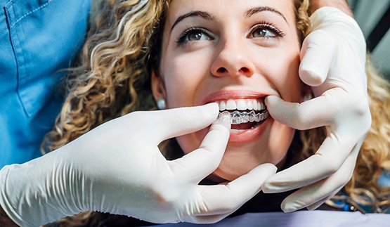 Dentist putting clear aligner on patient