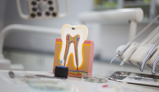 Model of the inside of the tooth