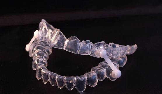 Oral appliance