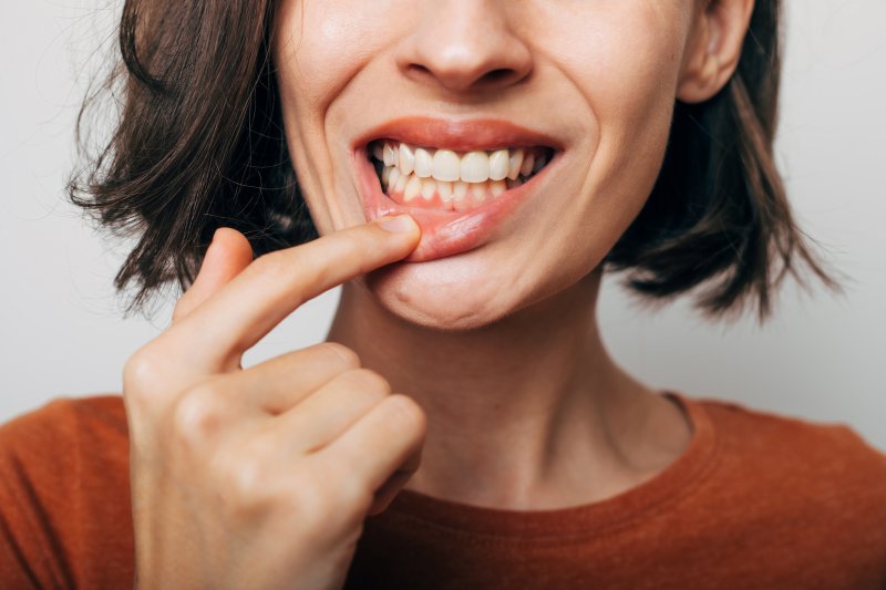 A woman revealing her inflamed gums